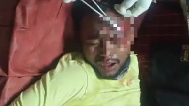 হাড়োয়া: হামাদামা এলাকায় মোটরবাইক দূর্ঘটনায় গুরুতর জখম যুবক ভর্তি বারাসত জেলা হাসপাতালে