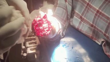 ములుగు: బండారుపల్లిలో ఘోర ప్రమాదం.. తెగిన చేయి..!