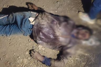 सीहोर: हाईवे पर लसुड़िया परिहार के पास सड़क हादसा, युवक गंभीर रूप से घायल, अस्पताल में भर्ती