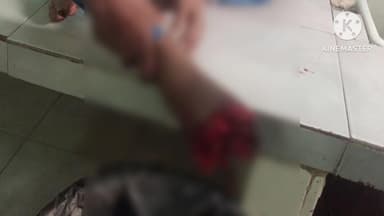 మహబూబాబాద్: గుండ్రాతిమడుగు వద్ద రైల్వే ట్రాక్ దాటుతుండగా రైలు ఢీకొని వెంకన్న అనే వ్యక్తికి తీవ్ర గాయాలు ఏరియా ఆసుపత్రికి తరలింపు