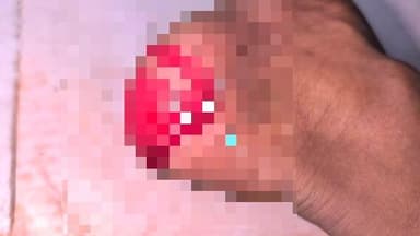 মন্দিরবাজার: বটতলা এলাকায় বাইক ও সাইকেলের মুখোমুখি সংঘর্ষে আহত সাইকেল আরোহী