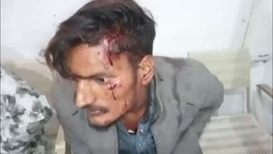 जबलपुर: शराब के लिए पैसे न देने पर बदमाश ने युवक पर किया जानलेवा हमला, खून से लथपथ युवक पहुंचा आधारताल थाने