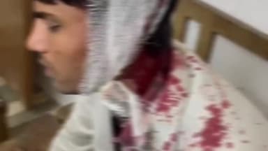 देेेवरिया: भटनी में मिठाई विवाद पर हुए हमले में दूल्हा गंभीर रूप से घायल