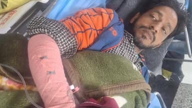 सैदपुर: बकरी को टक्कर मारने का विरोध करने पर बदमाशों ने चाय विक्रेता के हाथ-पैर तोड़े, 4 पर दर्ज हुआ मुकदमा