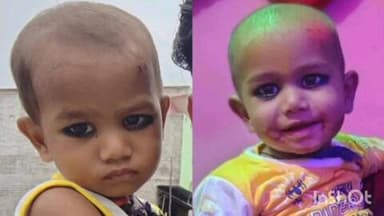 बिधूना: पटना के बेला गांव में दो मासूमों को पिलाया गया कफ सिरप, एक बच्चे की मौत, दूसरा गंभीर हालत में