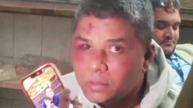 गोवर्धन: थाना पुलिस ने राजस्थान में दरोगा नितिन त्यागी की पिटाई की, घायल अवस्था में अस्पताल में कराया भर्ती