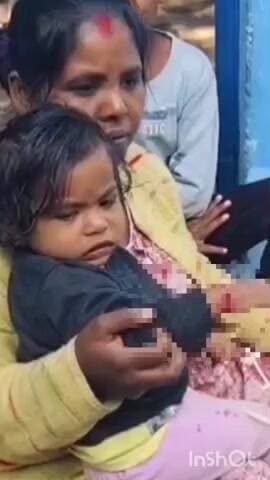 मनेंद्रगढ़ में आवारा कुत्तों का आतंक, आठ लोग हुए घायल—नगर पालिका ने बनाई विशेष टीम