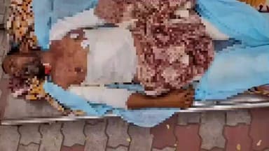 రాయదుర్గం: డి.హిరేహాల్ లో చలి కాచుకుంటూ మంటలు అంటుకుని తీవ్రంగా గాయపడిన వ్యక్తి చికిత్స పొందుతూ మృతి