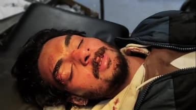 ਕਪੂਰਥਲਾ: ਸੁਲਤਾਨਪੁਰ ਲੋਧੀ ਰੋਡ 'ਤੇ ਸ਼ੇਖੂਪੁਰ ਚੁੰਗੀ ਨੇੜੇ ਕਾਰ ਵਲੋਂ ਟੱਕਰ ਮਾਰੇ ਜਾਣ ਕਾਰਨ ਮੋਟਰਸਾਈਕਲ ਸਵਾਰ ਪਿਓ ਪੁੱਤਰ ਜ਼ਖਮੀ