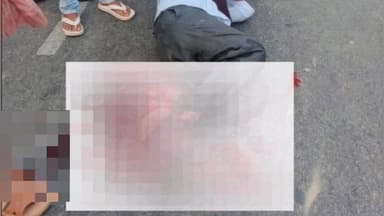 ಶ್ರೀರಂಗಪಟ್ಟಣ: ಪಟ್ಟಣದ ಮೈ-ಬೆಂ ಹೆದ್ದಾರಿಯಲ್ಲಿ ಸ್ಕೂಟರ್ ಗೆ ಟಿಪ್ಪರ್ ಡಿಕ್ಕಿ,ಸವಾರನ ಎರಡು ಕಾಲು ಕಟ್