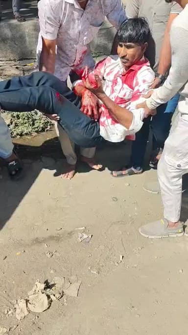 मुबाई अंबिका ज्वेलर्स वालिव अभी-अभी ज्वेलर्स की दुकान में हादसा हुआ है पेट में चाकू मारा लुटेरो ने