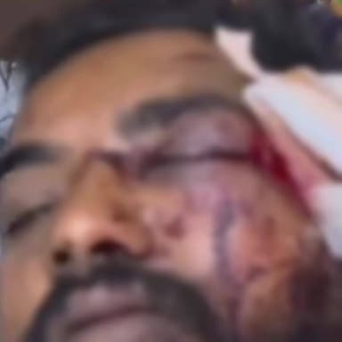 રાજકોટ દક્ષિણ: દેવનગરના ઢોરા પાસે અપહરણ કરી યુવકને માર મારવાની ઘટનાના સીસીટીવી સામે આવ્યા, પોલીસે આરોપીઓને ઝડપી પાડવા કવાયત હાથ ધરી