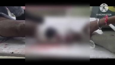 कैलारस: निरारा के पास सड़क दुर्घटना में बाइक सवार गंभीर रूप से घायल, कैलारस अस्पताल में भर्ती, मुरैना रेफर