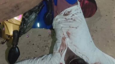 ಸಂಡೂರು: ಬಂಡ್ರಿ ಗ್ರಾಮ ಬಳಿ ನಿಂತಿದ್ದ ಲಾರಿಗೆ ಬೈಕ್ ಡಿಕ್ಕಿ: ಸ್ಥಳದಲ್ಲೇ ಸವಾರ ಸಾವು