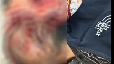 ଲୋଇସିଂହା: ଛୁଇ ବନ୍ଦ ନିକଟରେ ଅଜଣା ଗାଡ଼ିର ଧକ୍କାରେ ଜଣେ ମୃତ ଜଣେ ଗୁରୁତର ମେଡ଼ିକାଲରେ ଭର୍ତ୍ତି