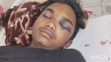 रमना: दो मोटरसाइकिल की टक्कर में एक किशोर की मौत, पुलिस जांच में जुटी