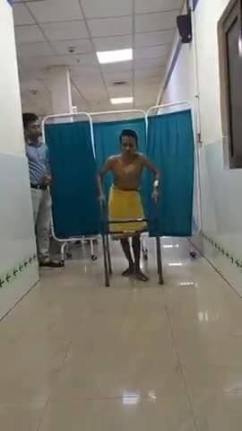 ଖଣ୍ଡଗିରି: ଏମ୍ସ ଭୁବନେଶ୍ୱର ଅର୍ଥୋପେଡିକ୍ ବିଭାଗ ପକ୍ଷରୁ ଜୀବନ ପରିବର୍ତ୍ତନକାରୀ ଅସ୍ତ୍ରୋପଚାର, ଦୁଇ ଦଶନ୍ଧି ପରେ ଯୁବକଙ୍କ ଜୀବନରେ ଆସିଲା ଖୁସି