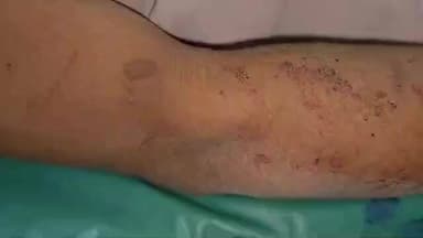 कर्वी: इटवां गांव से घायल युवक एम्बुलेंस से CHC मानिकपुर पहुंचे, मारकुंडी पुलिस पर बेरहमी से मारपीट का लगाया आरोप