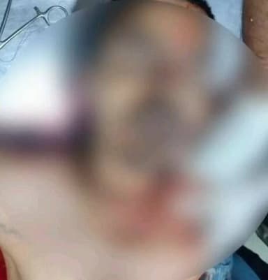 रायपुर: रायपुर में ई-रिक्शा चालक ने की हत्या की कोशिश, चाकू मारकर हुआ फरार