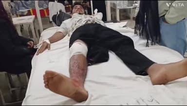 आबापुरा: कल्याणपुरा गांव के पास बाइक अनियंत्रित होकर गड्ढे में गिर गई, युवक को लगी चोट, एमजी अस्पताल में उपचार जारी