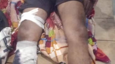 बांसगांव: गगहा में बाइक पोल से टकराई, रकहट-गोबरहिया मार्ग पर एक युवक घायल, निजी अस्पताल में भर्ती