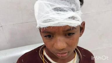 बिहटा: खेदलपुरा गांव में पुराने विवाद के चलते दो पक्षों में मारपीट, तीन बच्चे घायल