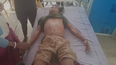 গাজোল: ১৯ বছরের ১ যুবক সৌচালয় ফিরতে গিয়ে সৌচালয়ের মধ্যে পড়ে পেটের ব্যথায় মৃত্যু হলো রানীগঞ্জ তিতি ডাঙ্গা গ্রাম এলাকায়