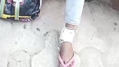 भभुआ: देवरिया में कुछ लोगों ने लड़की के साथ मारपीट कर किया घायल, पिता ने एससी एसटी थाने में दिया आवेदन, सदर में कराया गया इलाज