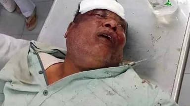 దోమకొండ: సిరిసిల్లకు వెళ్తుండగా తిమ్మాపూర్ కెనాల్ వద్ద, రోడ్డు గుంతల కారణంగా, ద్విచక్ర వాహనం బోల్తా పడి ఇద్దరికీ తీవ్ర గాయాలు