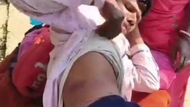 पीरपैंती: पीरपैंती में निर्माणाधीन ऊर्जा ताप घर में काम कर रहा एक मजदूर घायल