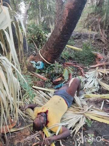 వర్ధన్నపేట: చెన్నారం గ్రామంలో తాటి చెట్టు పైనుండి పడి వ్యక్తికి గాయాలు