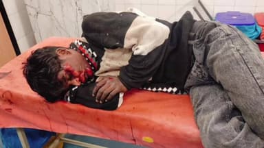 भंडरा: भंडरा-चट्टी मुख्य मार्ग पर सड़क हादसा, बाइक अनियंत्रित होने से युवक घायल, सीएचसी भंडरा में इलाज जारी