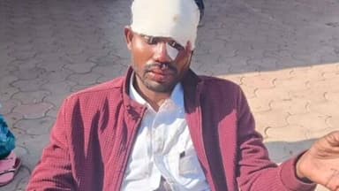 जैतहरी: जुमुडी के पास बंदर की छलांग से स्कूटी दुर्घटना, दो युवक घायल