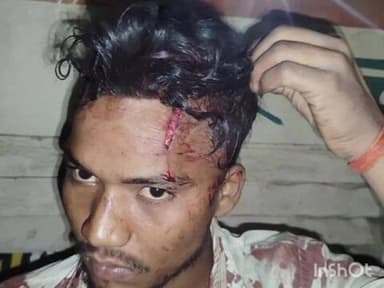 टांडा: जलालपुर में नाबालिग से छेड़खानी और चाचा से मारपीट, पुलिस ने शिकायत दर्ज कर जांच शुरू की