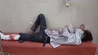 पयागपुर: पटियर भट्टे के पास तेज रफ्तार ट्रक ने बाइक को मारी टक्कर, हादसे में बाइक सवार दो सगे भाई घायल, इलाज जारी