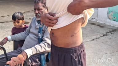 ब्रह्मपूरी: सावकारीच्या तगाद्यामुळे एका तरुणाला आपली किडनी विकावी लागलीया प्रकरणी सहा आरोपींविरोधात गुन्हा दाखल करण्यात आला आहे.