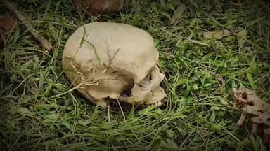 দাঁতন ১: দাঁতনে খালের ধার থেকে উদ্ধার হল নর কঙ্কাল!