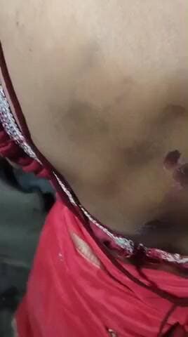 मर पीट की घटना,फूल कुमारी और जेठानी प्रेमा के साथ मर पीट किया ,वो भी घर मैं घुस कर