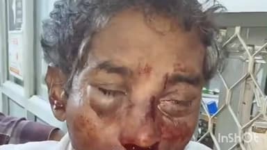 सोरांव: सड़क पार कर रहे अधेड़ को बाइक सवार ने मारी टक्कर, हालत चिंताजनक