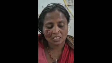 मीनापुर: टेंगराहां गांव में आवारा कुत्ते के हमले से एक महिला गंभीर रूप से घायल, अस्पताल में भर्ती