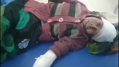 इकौना: इकौना धनुही मार्ग पर तेज रफ्तार कार की टक्कर से महिला गंभीर रूप से घायल, CHC इकौना से हायर सेंटर रेफर