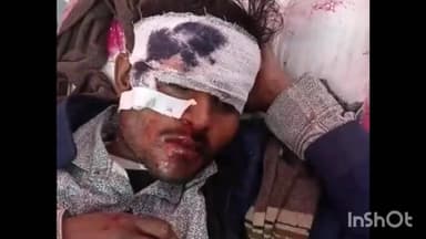 रामसनेही घाट: कोटवा सड़क के पास दो बाइकों में हुई टक्कर, एक बाइक पर सवार दो लोग गंभीर रूप से घायल