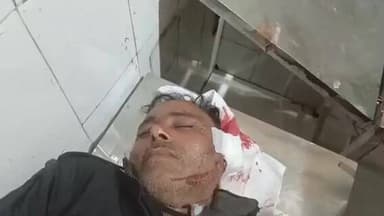 महोली: बड़ा गांव में विवाद के चलते रंजिश के कारण दबंगों ने बुजुर्ग पर किया जानलेवा हमला, उपचार जारी