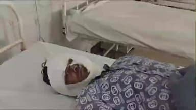 कुरई: जमुनिया गांव में चूल्हे की आग से झुलसा युवक, जिला अस्पताल में भर्ती