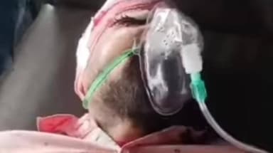 कस्बा: कस्बा थाना क्षेत्र में अपराधियों ने नाईट गार्ड पर किया जानलेवा हमला