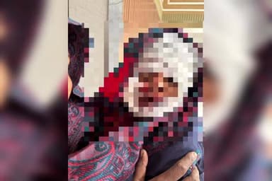 पटियाली: कासगंज से गंजडुंडवारा मार्ग पर सड़क दुर्घटना में मासूम घायल