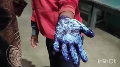 वारिसनगर: खेल के दौरान एक बच्चे ने दूसरे बच्चे को आग में धकेला,बच्चों का हाथ जला, शिक्षकों ने बच्चों का नहीं कराया इलाज।