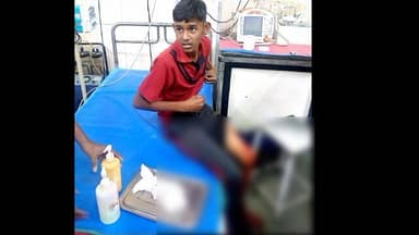 कामठी: खळबळजनक!टी पॉइंट जवळ 13 वर्षाच्या चिमुकल्यावर चाकूने जीवघेणा हल्ला