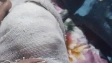 মন্দিরবাজার: লক্ষীকান্তপুর এলাকায় বেপরোয়া বাইকের ধাক্কায় আহত এক পথচারী