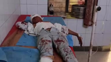 गंगधार: गंगधार में सड़क किनारे पतंग उड़ा रहे किशोर को बाइक ने मारी टक्कर, किया गया जिला चिकित्सालय रेफर